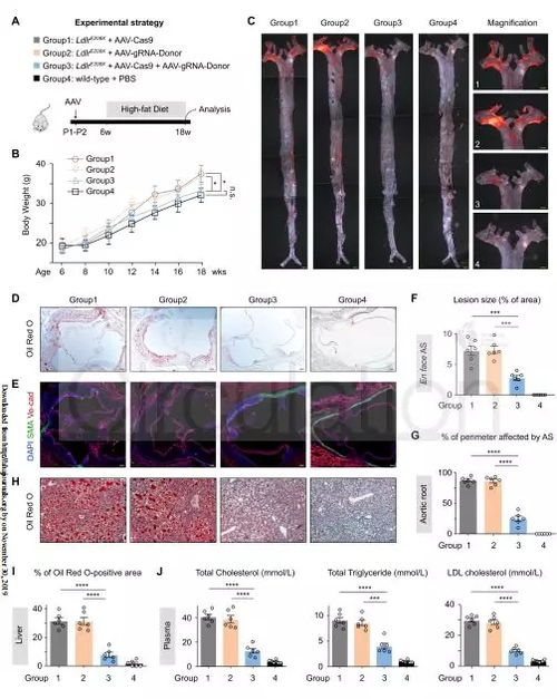 AAV-CRISPR/Cas9系统有效改善LDLR突变所致动脉粥样硬化——周斌与黄荷凤课题组合作研究突破